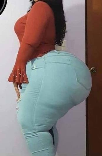 Example of Steatopygia condition in human body. PHOTO/Pixels