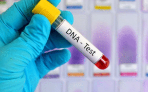 DNA test kit. PHOTO/Jubilee Radio.