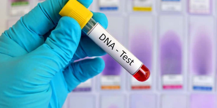 DNA test kit. PHOTO/Jubilee Radio.