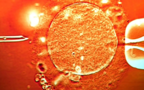 The Donor's Sperm was used in Clinics Across Europe. PHOTO/ (stock image)