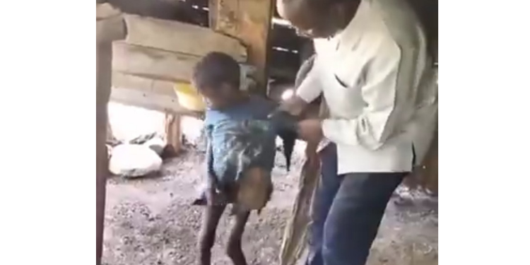 The 9- Year Old Boy from Meru Suffering from Autism Who Had Been Caged by the Grandparents. PHOTO/ File