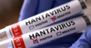 A lab specimen tube labelled with Hantavirus disease name for illustration purposes. PHOTO/ Google