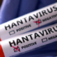 A lab specimen tube labelled with Hantavirus disease name for illustration purposes. PHOTO/ Google