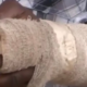 A photo af a man who was bitten by the attacker PHOTO/KBC