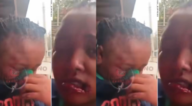 Unidentified woman who was lured and her lower lips bitten by the mysterious 'Ruiru Vampire Man' in alleged process of merry making. PHOTO/ File