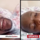 Man Breaks Silence After Midnight Dispute Turns Horrific, Says He Was Burnt With Hot Water