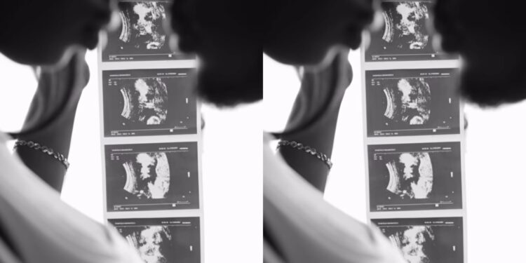 An ultrasound photoPHOTO/IG